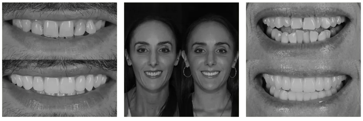 Before and after transformation row 2