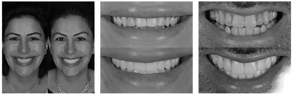 Before and after transformation row 2