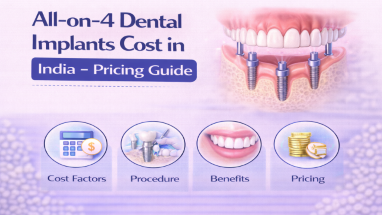 All-on-4 Dental Implants Cost in India Pricing Guide