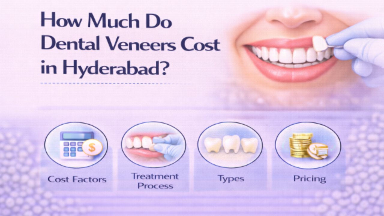 How Much Do Dental Veneers Cost in Hyderabad_ Latest Price Guide