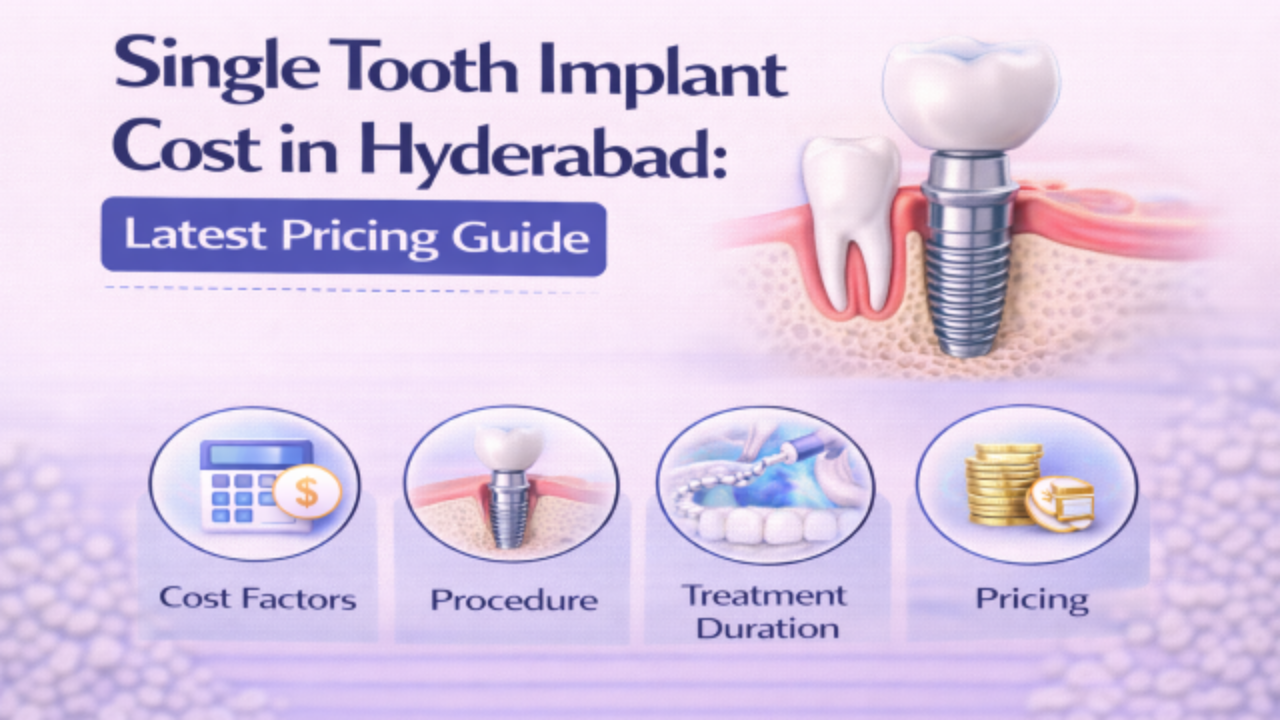 Single Tooth Implant Cost in Hyderabad_ Latest Pricing Guide
