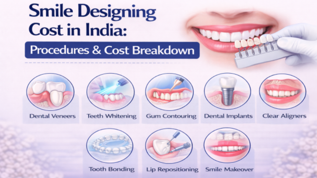 Smile Designing Cost in India_ Procedures & Cost Breakdown