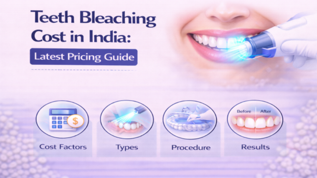 Teeth Bleaching Cost in India_ Latest Pricing Guide