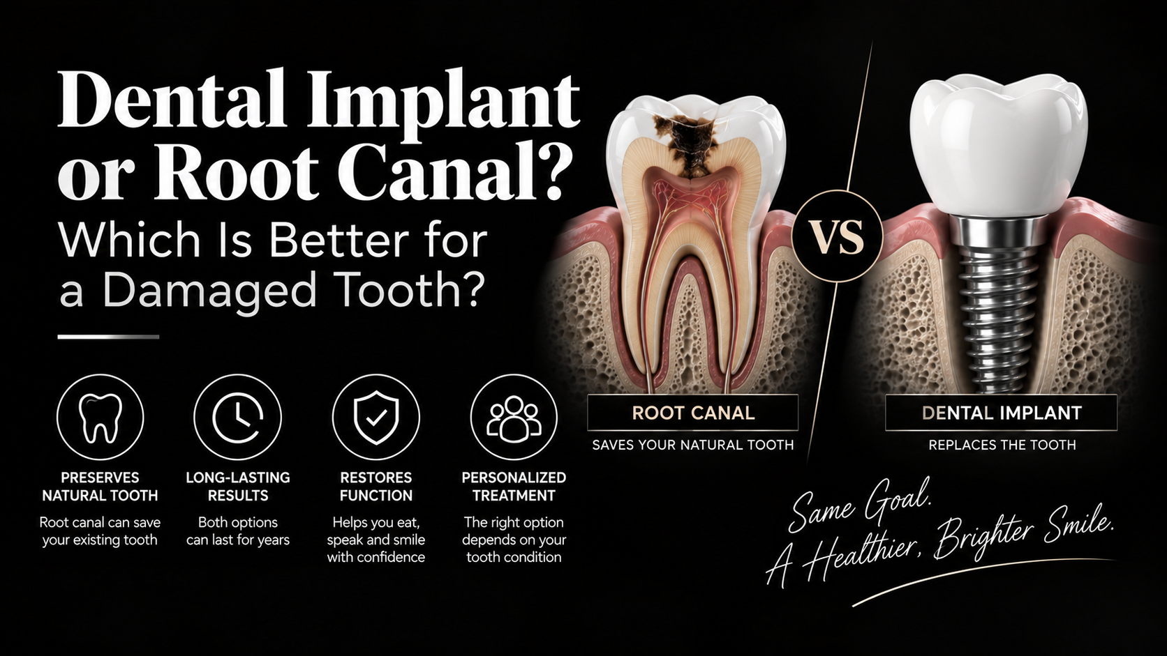 Dental Implant or Root Canal Which Is Better for a Damaged Tooth